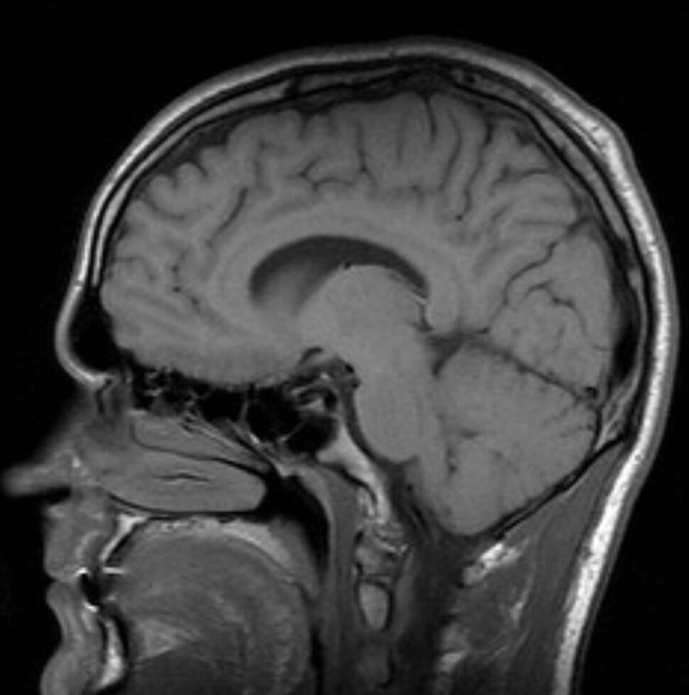 New Study Suggests Listening to Music Most Days Can Lower Dementia Risk